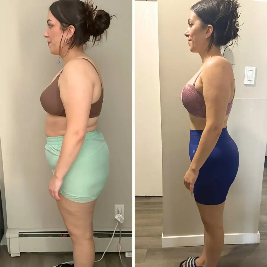 Juliana — Perdeu 8kg após a gravidez